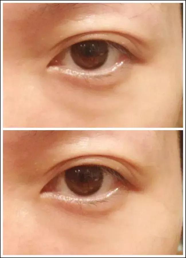 30块钱让你白到透明！不好用我撞豆腐！