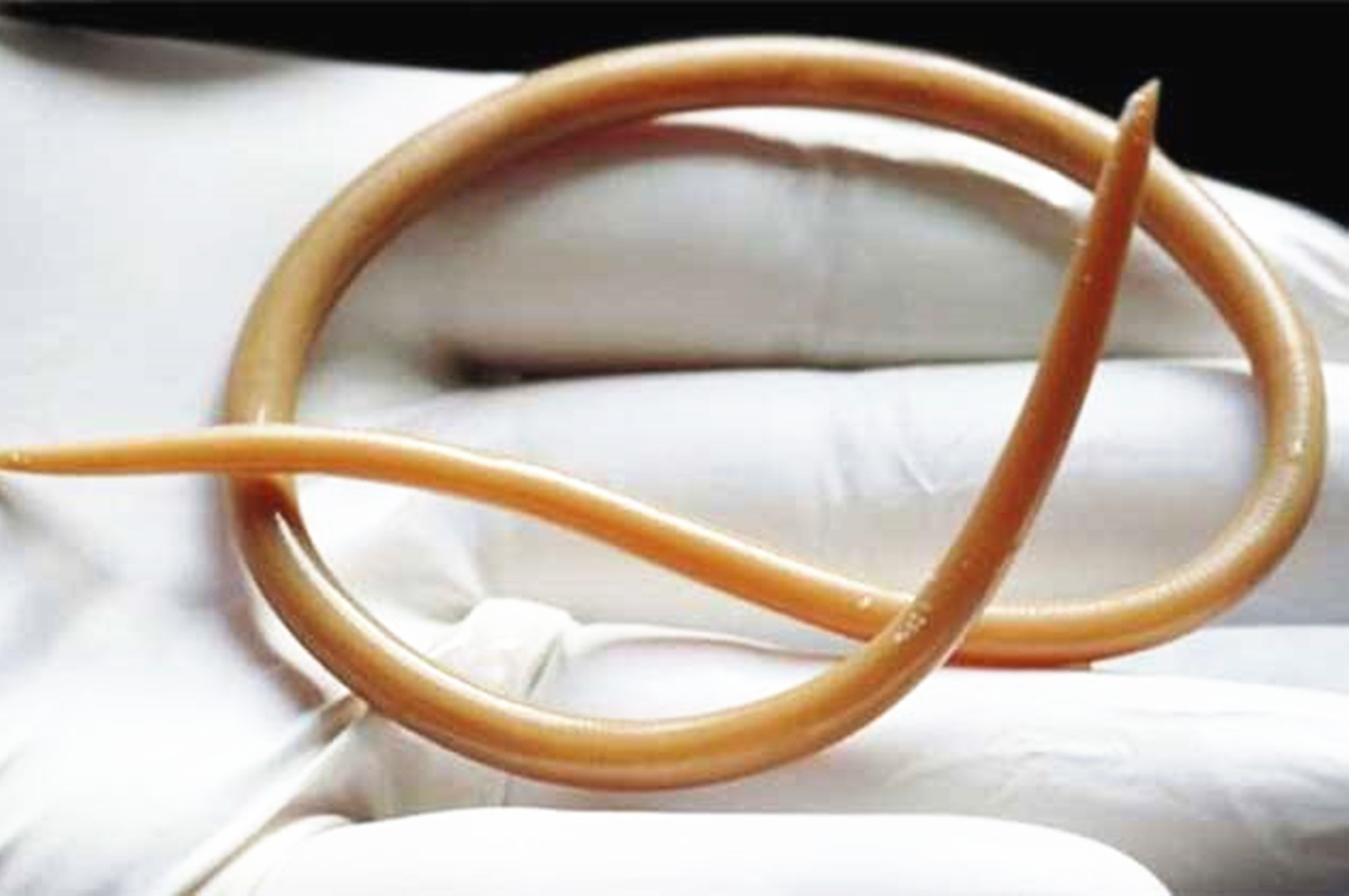 孩子有这四种表现，说明肚子里有蛔虫，父母别不当一回事