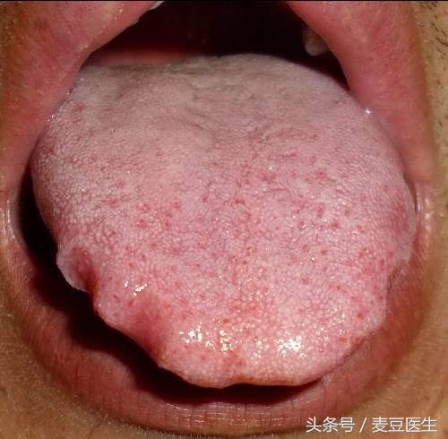 最全中医舌诊图谱来啦！看舌头，知全身！