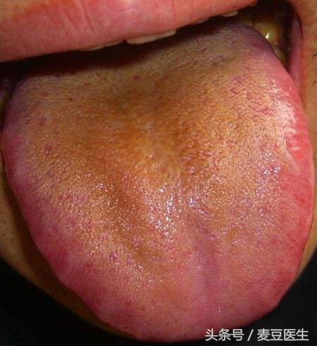 最全中医舌诊图谱来啦！看舌头，知全身！