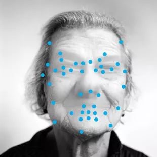 卡普格拉妄想症可以治好吗,脸盲症在心理学里叫什么