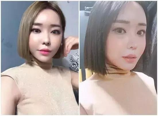 变性手术韩国网红,千万网红自曝变性后遗症