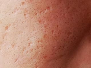 轻轻抹一抹皮肤越来越好,轻轻擦到皮肤就留下黑印子