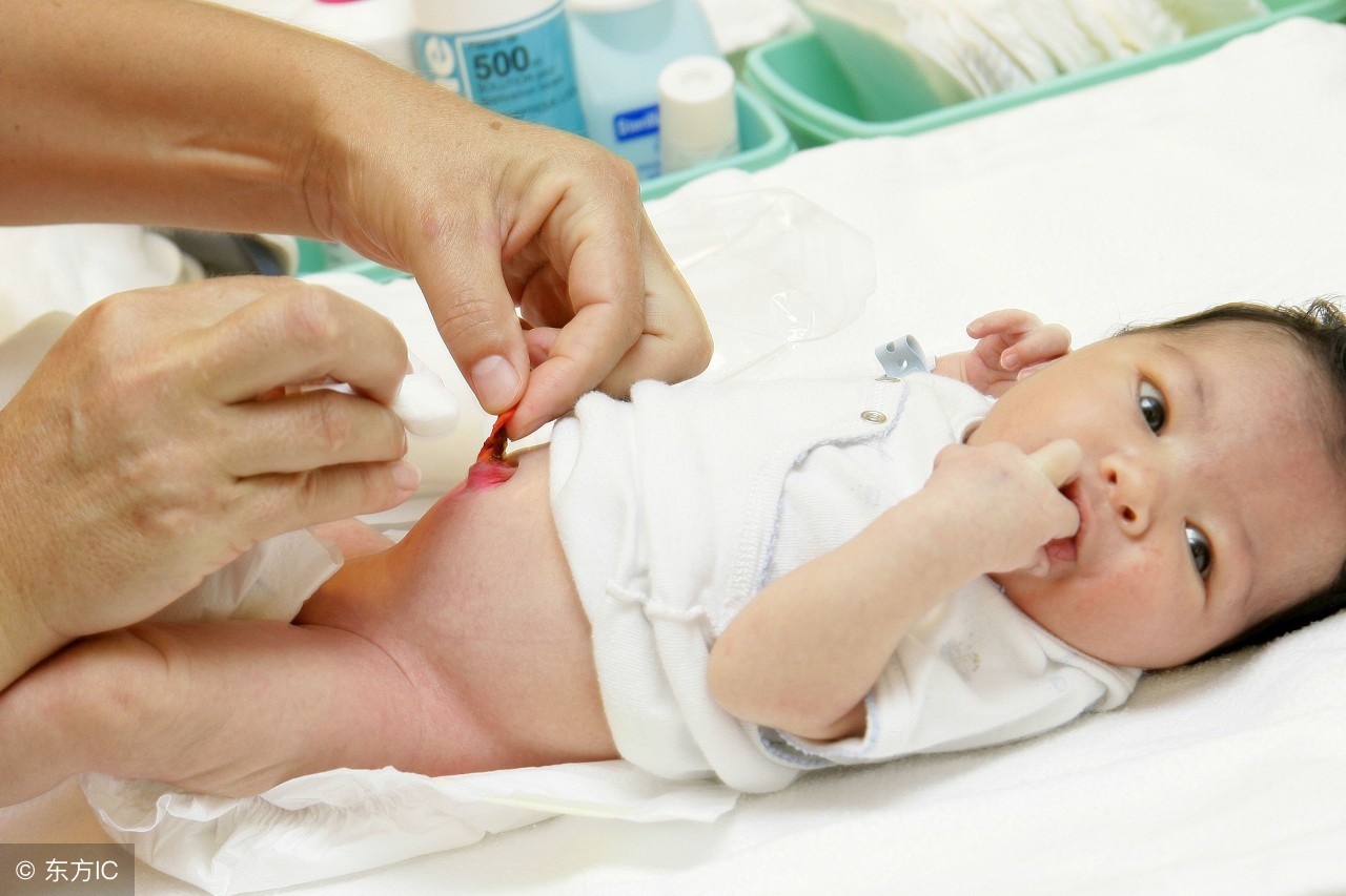 新生儿脐部渗液渗血怎么护理,新生儿护理全攻略新手爸妈看过来