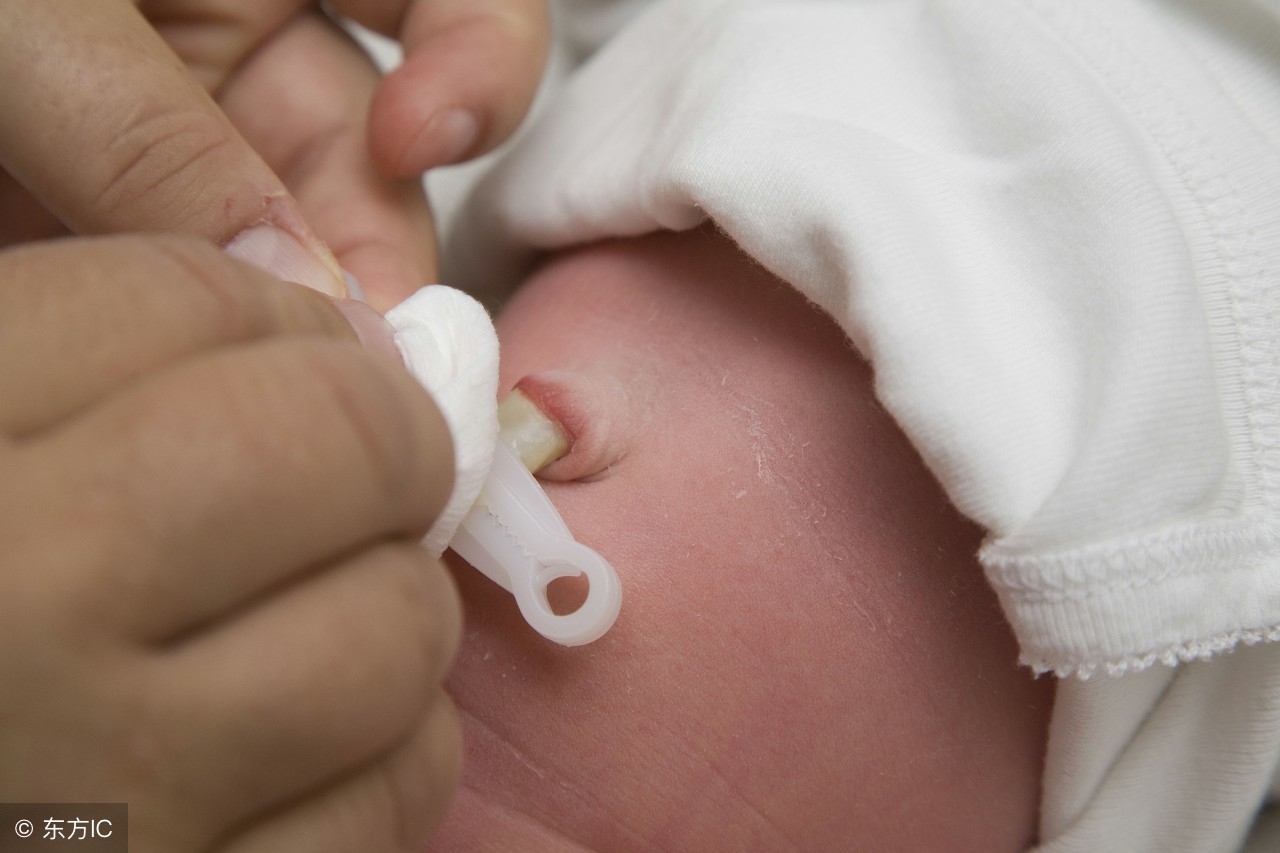 新生儿脐部渗液渗血怎么护理,新生儿护理全攻略新手爸妈看过来