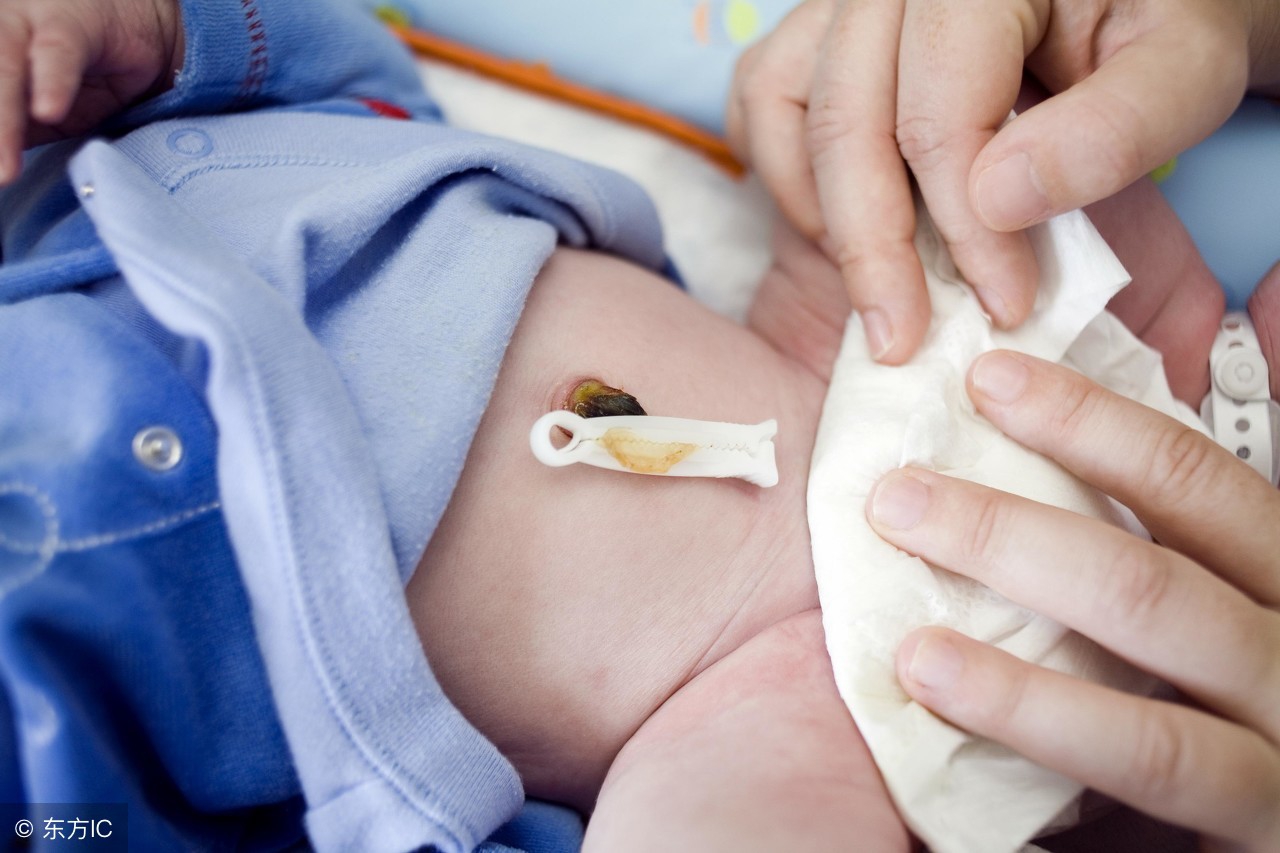 新生儿脐部渗液渗血怎么护理,新生儿护理全攻略新手爸妈看过来