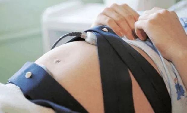 胎儿心跳159,关于胎儿的声音