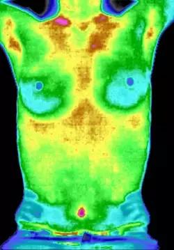 腋下难看的那两坨肉，可以转变为乳房吗？