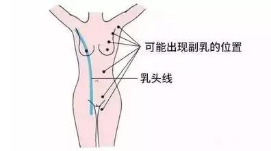 腋下难看的那两坨肉，可以转变为乳房吗？