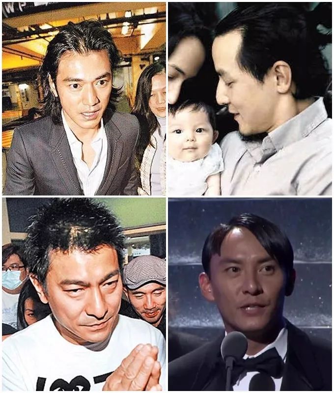 产后防脱发最好的偏方,生姜防脱发最有效的偏方