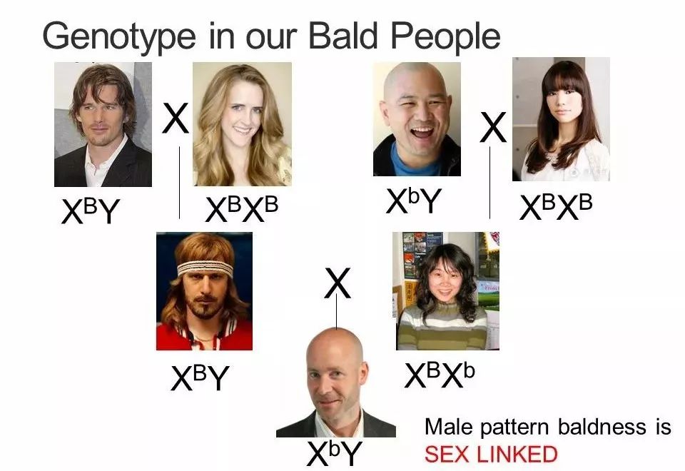 产后防脱发最好的偏方,生姜防脱发最有效的偏方