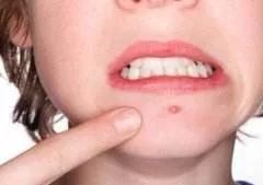 炎炎夏日当心皮肤病袭击,夏季预防紫外线过敏的化妆品