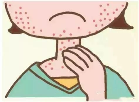 炎炎夏日当心皮肤病袭击,夏季预防紫外线过敏的化妆品