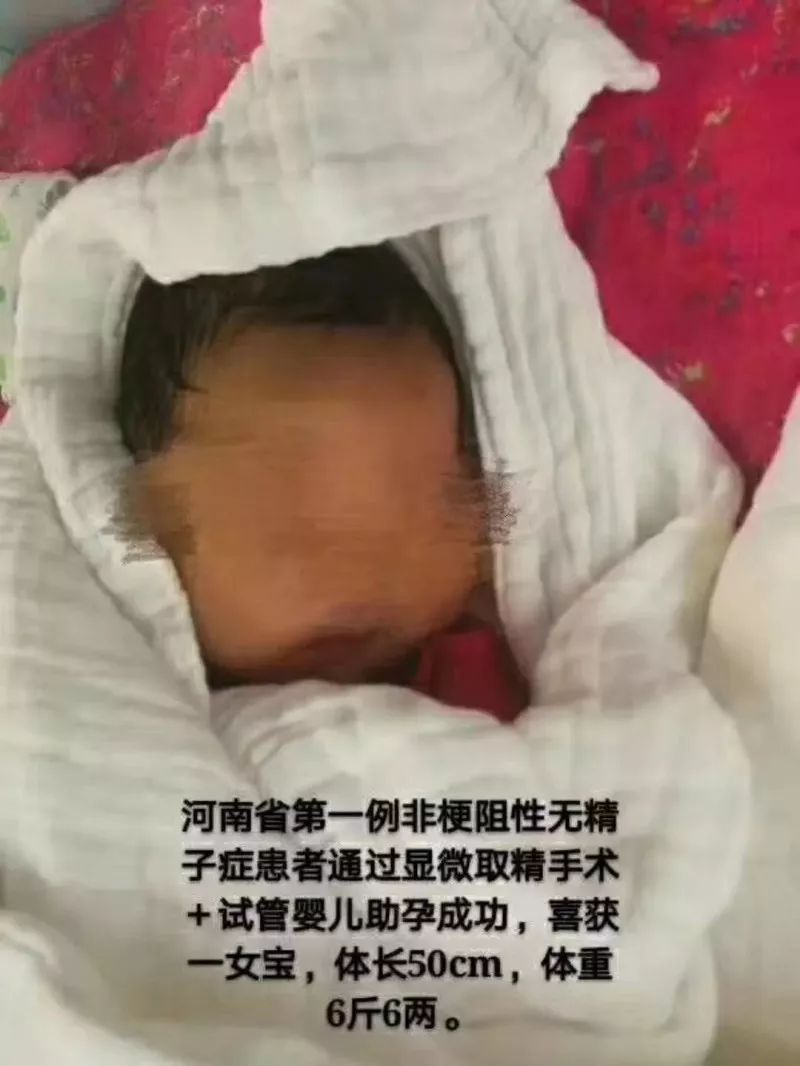 无精症遗传给女儿,无精症生的孩子会有缺陷吗