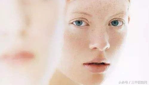 脸上有斑斑点点晒斑,怎么预防脸上起斑斑点点