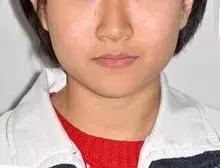 为什么牙齿矫正堪比整形,牙齿矫正堪比整容