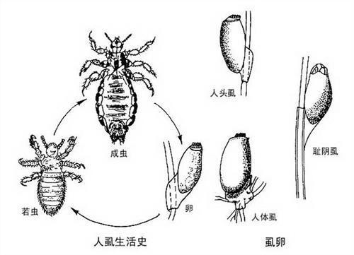 孩子头虱子怎么彻底去除,孩子头虱子怎么来的