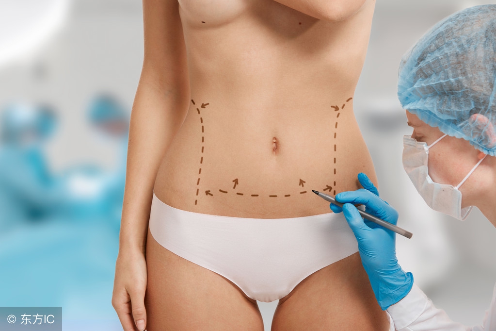 美国整形世界纪录,澳洲整形