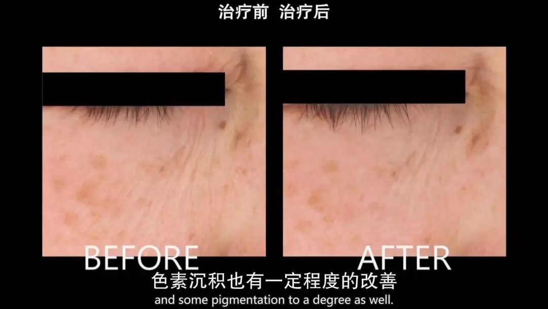 护肤科普小课堂抗皱,干货护肤成分大揭秘精致女生必看