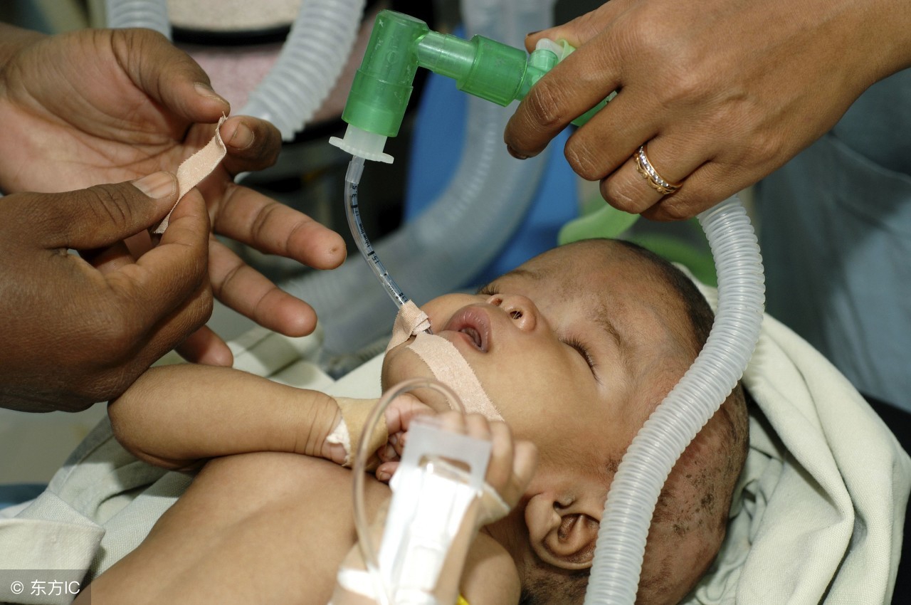 脑内积水是怎么造成的,脑中积水是什么引起的