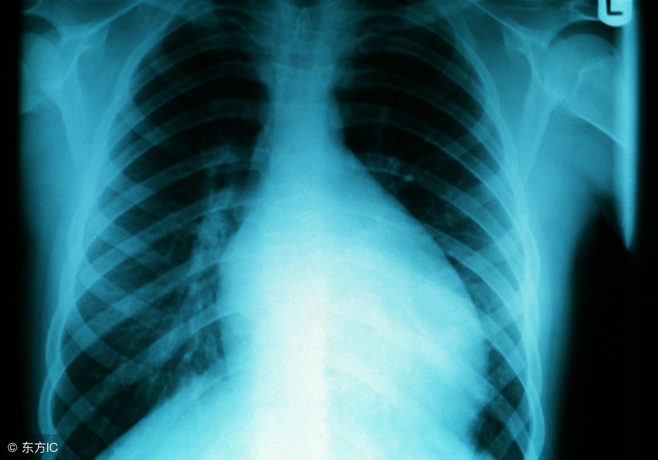 非感染性心肌炎的病因有,诱发心肌炎常见病因