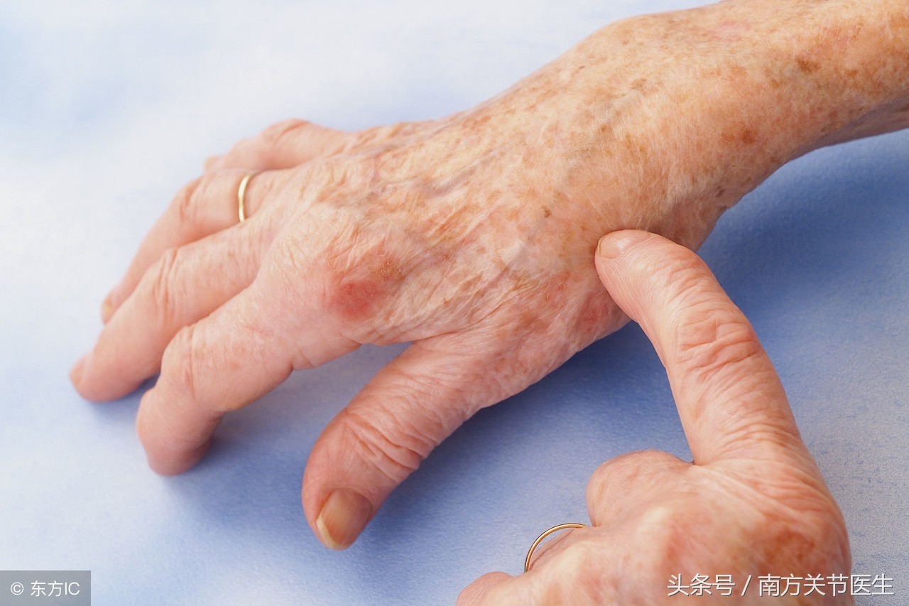 手指头发麻怎么治疗才能好,手指小指头发麻是怎么回事