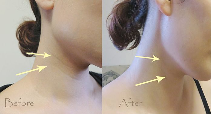 韩国品牌眼霜补水保湿,推荐一款韩国好用的眼霜