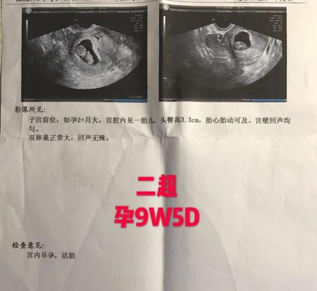 备孕：经历了翻倍乌龙后，我的经验小结