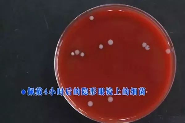 警惕来路不明的美瞳暗藏风险,99%都不知道的美瞳的危害