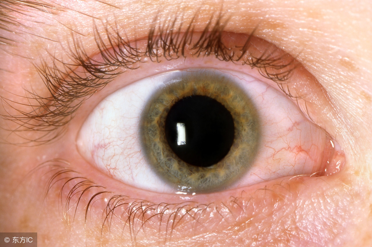 治疗哮喘合并过敏性鼻炎的药物,治疗过敏性鼻炎哮喘的药物有哪些