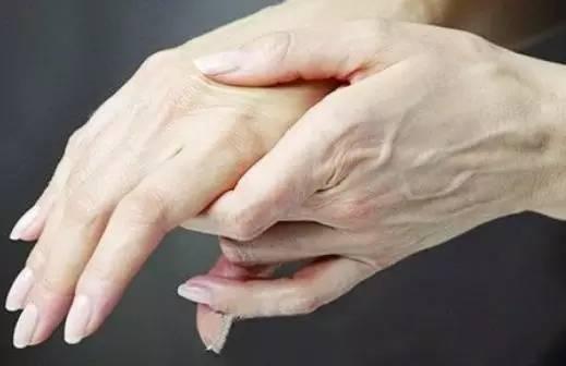 手上青筋怎么根治,可以看到手上的青筋是怎么回事