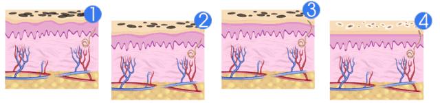 周迅20年前就一脸斑?日本30天击碎顽固斑的好物,快让她用用!