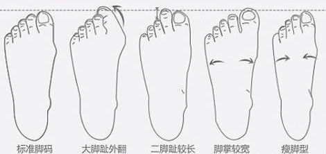 鞋子磨脚一招就能解决,新鞋子磨脚最有效方法