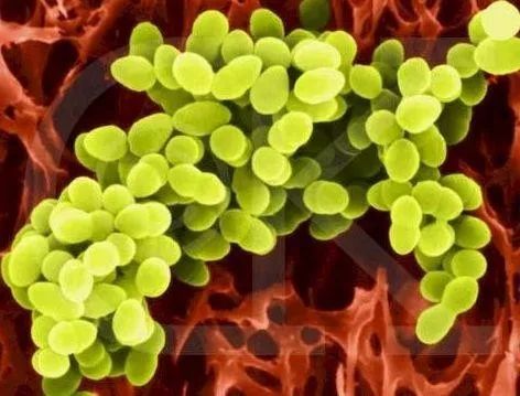 鞋子磨脚一招就能解决,新鞋子磨脚最有效方法