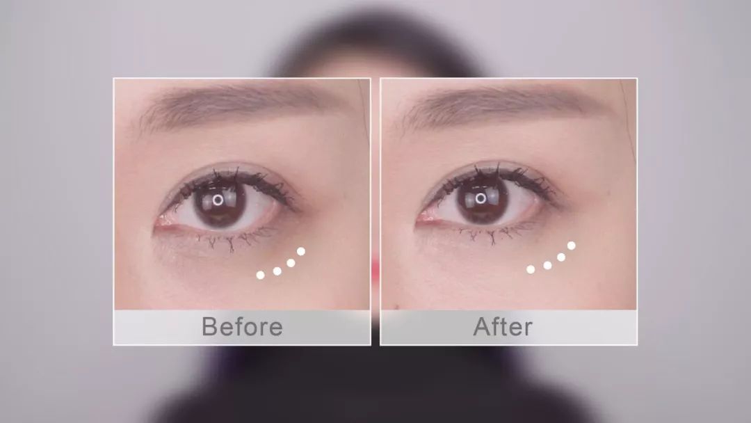 陆毅推荐眼膜,陆毅贝儿眼膜