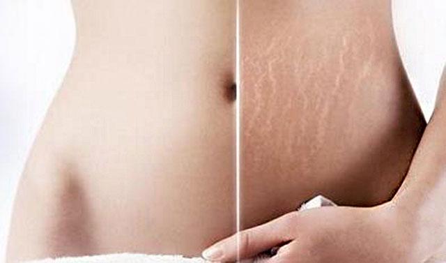 拒绝做个黄脸婆孕妇！孕产肌肤护理技巧看这里就够了