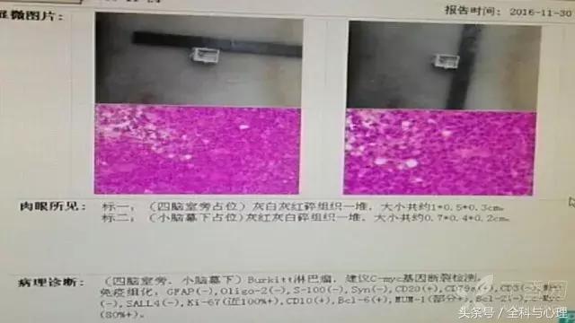 前庭中枢性症状怎么治,前庭中枢神经受损有什么好办法