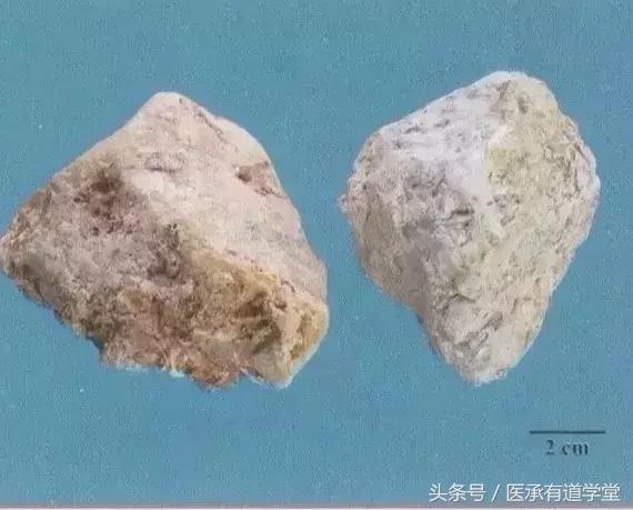 每天最少学一味中药赤小豆,每天最少学一味中药丝瓜络