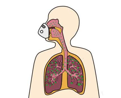 雾化治疗有什么利弊,科普您真的了解雾化治疗吗