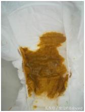 宝宝突然厌食还爱哭,宝宝突然厌食最快的解决方法