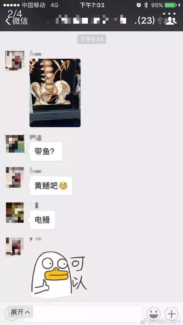 脑洞无限开新鲜的鱼,脑洞大开漏网之鱼