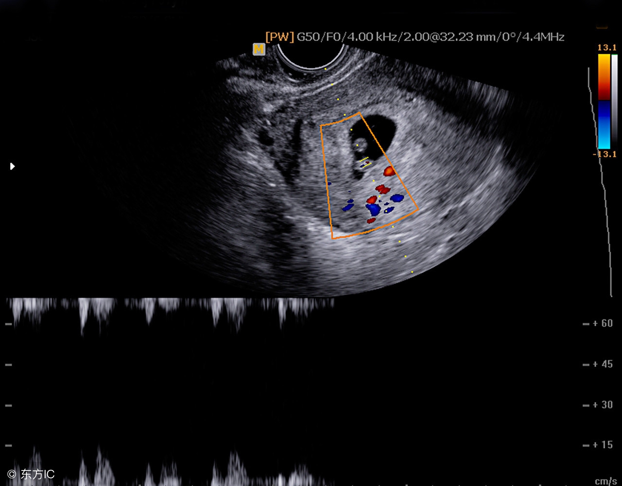 孕1-40周b超对照表,0-40周胎儿b超对照表