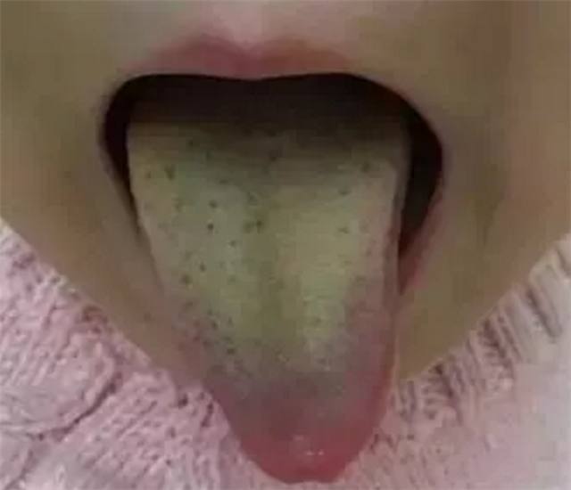 孩子睡着了咳嗽醒着不咳怎么回事,小孩睡着咳嗽醒了不咳是什么原因