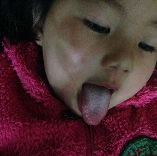 孩子睡着了咳嗽醒着不咳怎么回事,小孩睡着咳嗽醒了不咳是什么原因