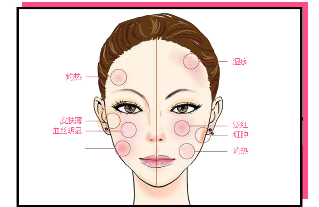为什么敷面膜越敷越黑,为什么天天敷面膜脸还是很干呢