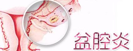 盆腔炎小便疼痛是怎么回事,月经后盆腔炎严重怎么回事