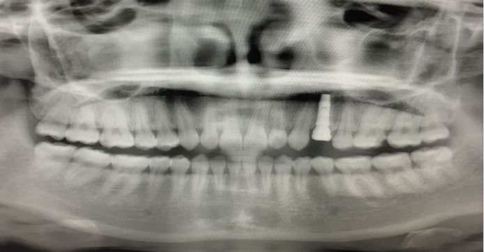 成都圣贝口腔到底好不好,成都圣贝牙科怎么样啊