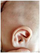 宝宝长湿疹怎么办有什么方法,宝宝得了湿疹怎么办呢科普视频