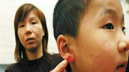 孩子耳朵旁有个小洞，是福气？快看看你家孩子有没有？