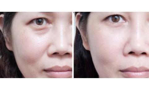 处女脸、果汁脸,你的老公鹿晗林更新们到底心水哪一款?